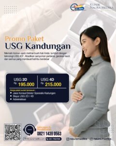 Promo USG 4D